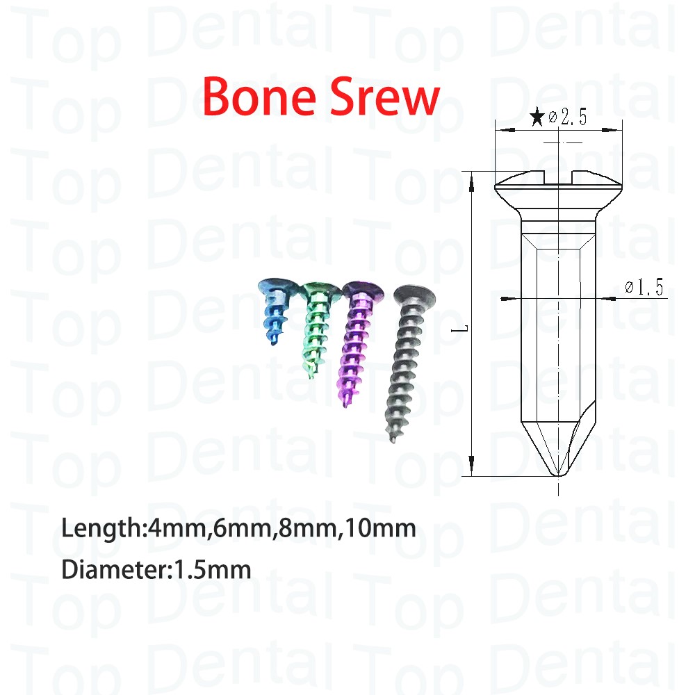 10pcs Dental GBR System Bone S - Stabilizer Screw In incelemesi ve fiyatı